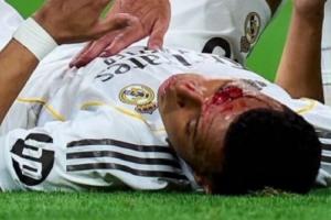 遭肘击流血！皇马官方：姆巴佩眉骨缝针，，，，，，缺席球队今日合练_24直播网