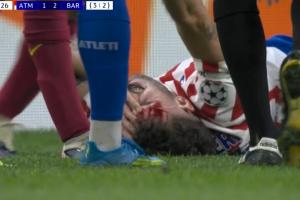 又血崩一个！鲁杰里被加维肘击倒地满脸是血，，加维染黄_24直播网